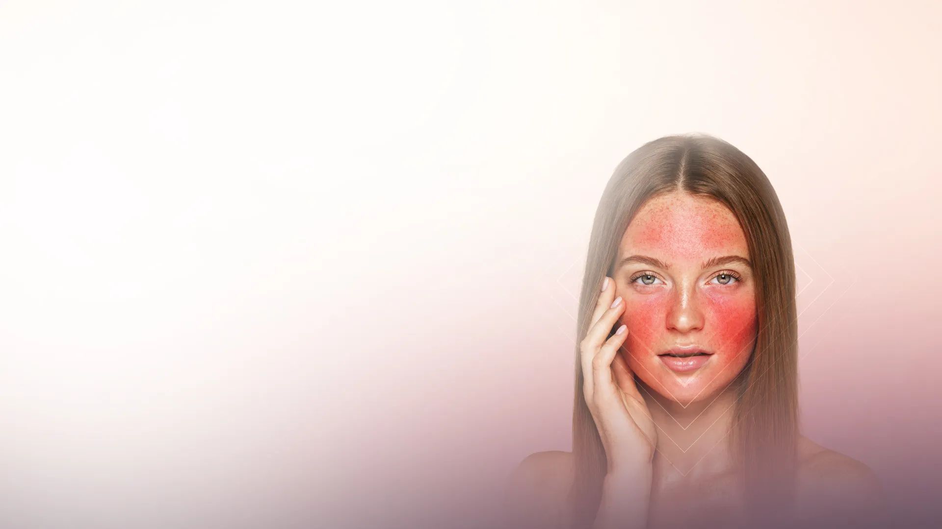 PRP Facial Rejuvenation (Vampire Facial) treatment at Toronto medical spa - Your Body Holds the Secret to Brighter, Firmer Skin...